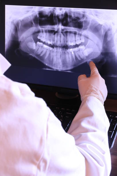 Best Emergency Dental Extractions in Dunean, SC